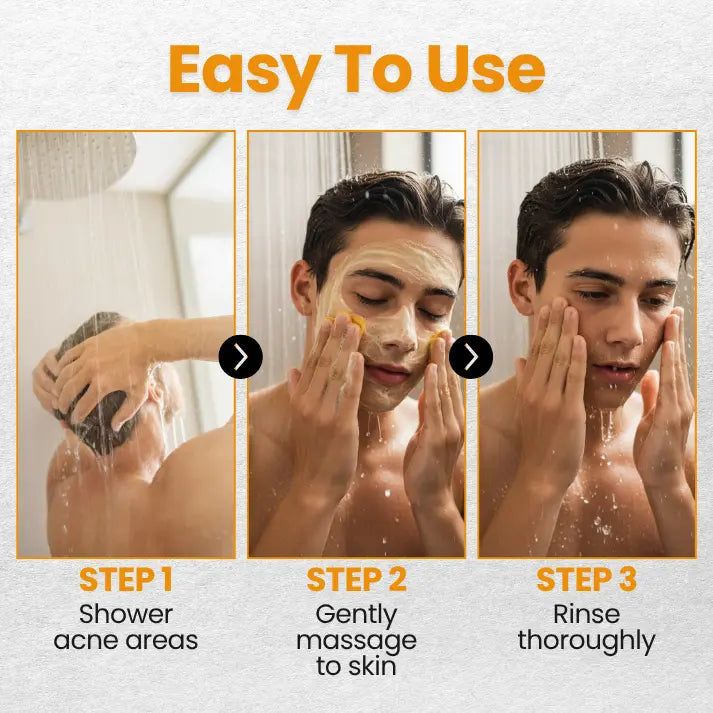 ClearTone,Anti-Acne & Spot Soap.